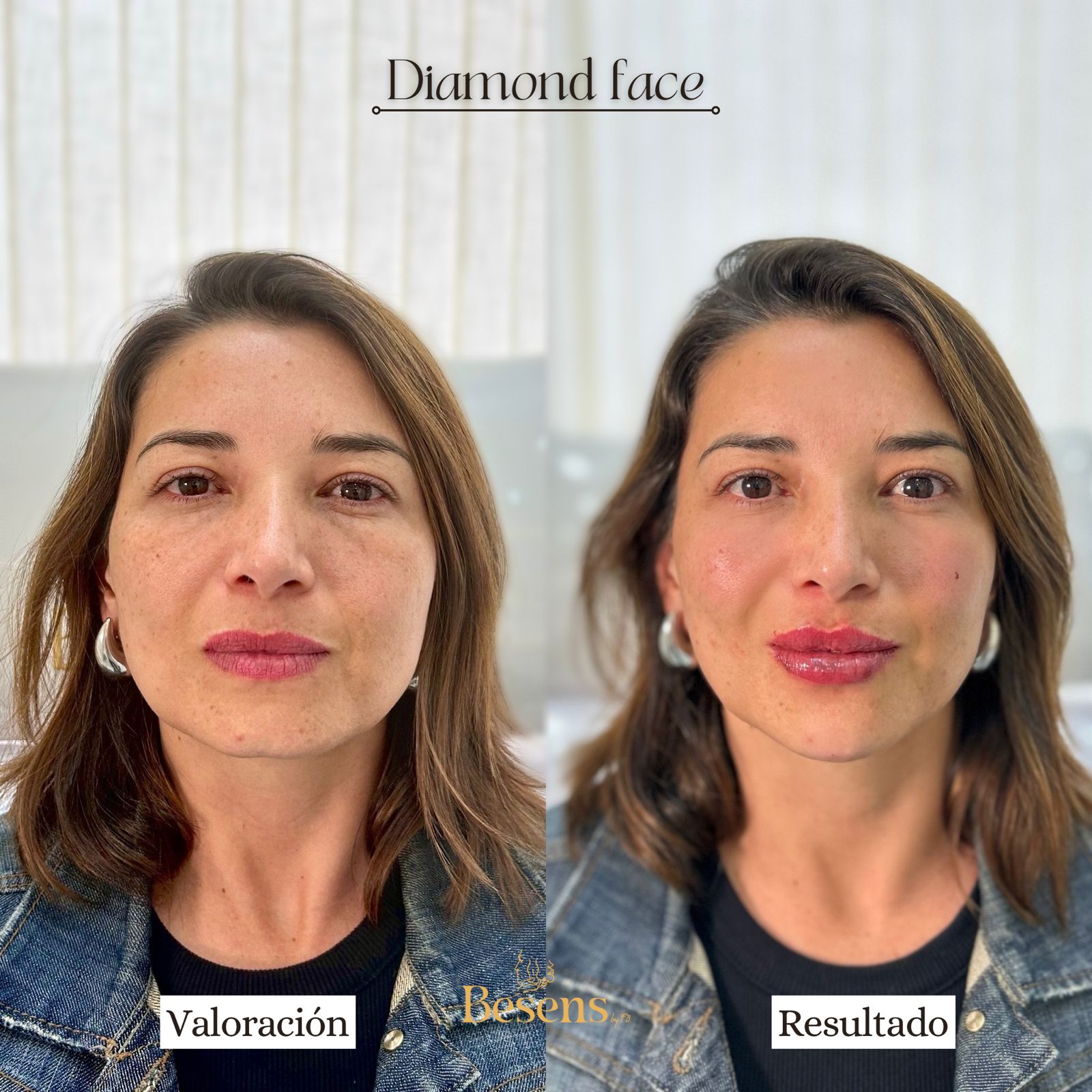 Paciente Full Face 4