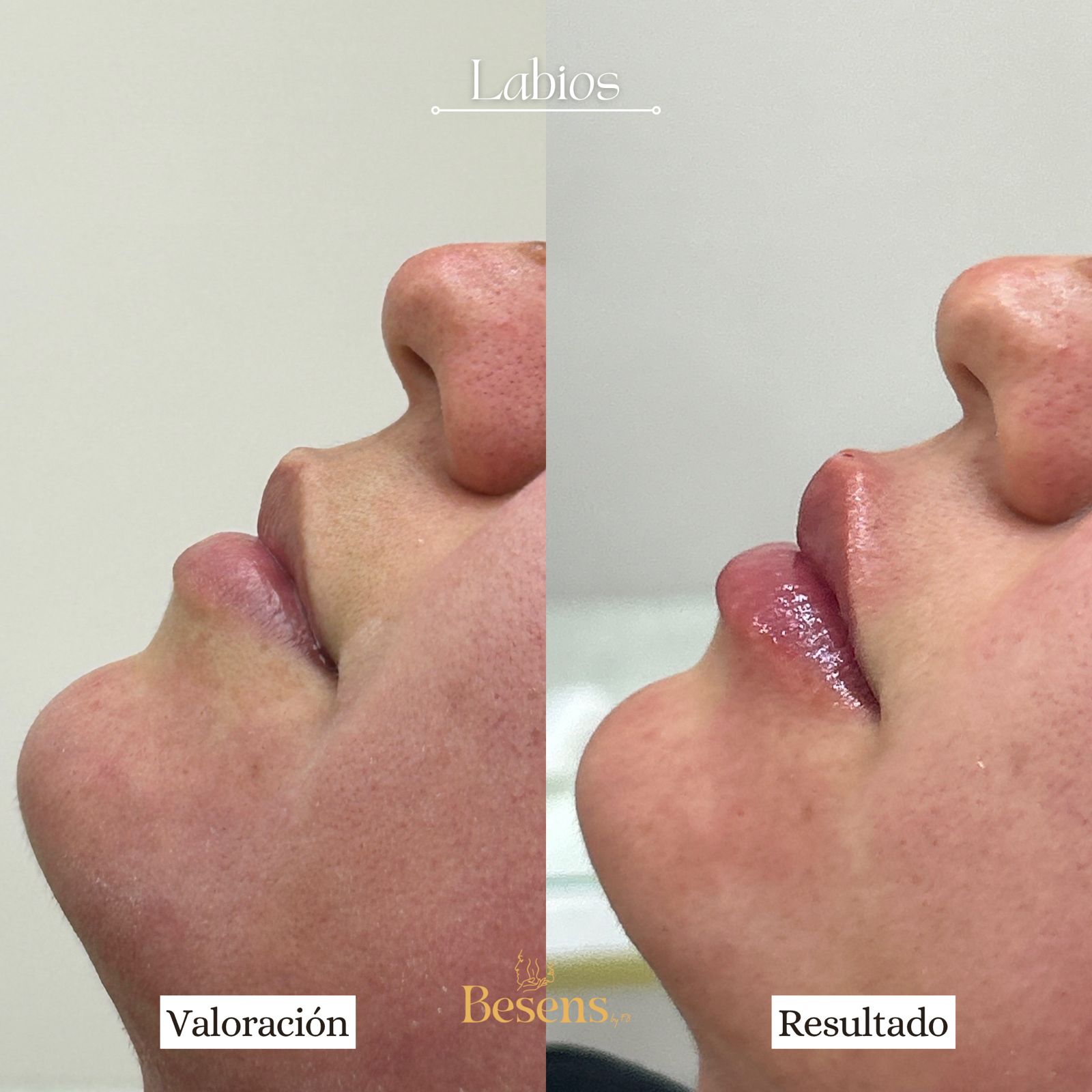 Paciente Labios 1
