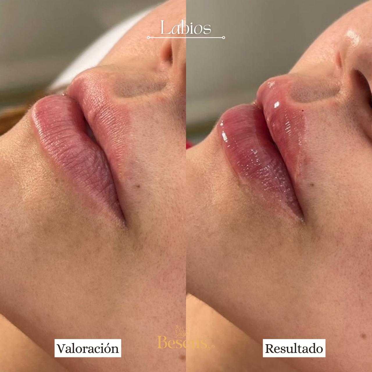 Paciente Labios 2