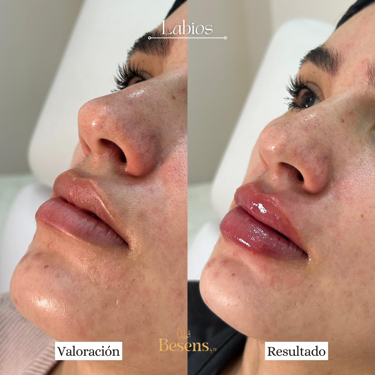 Paciente Labios 3