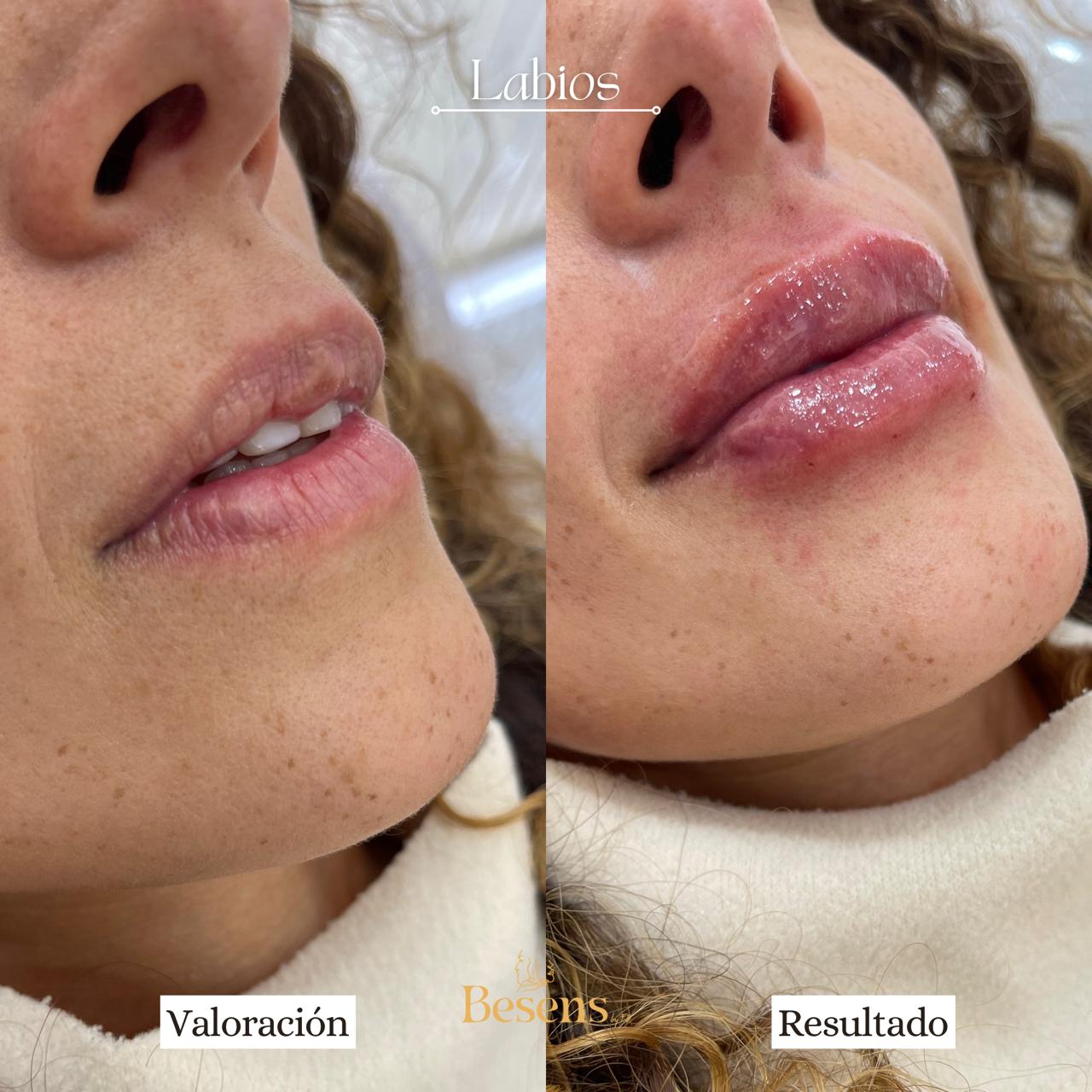 Paciente Labios 5