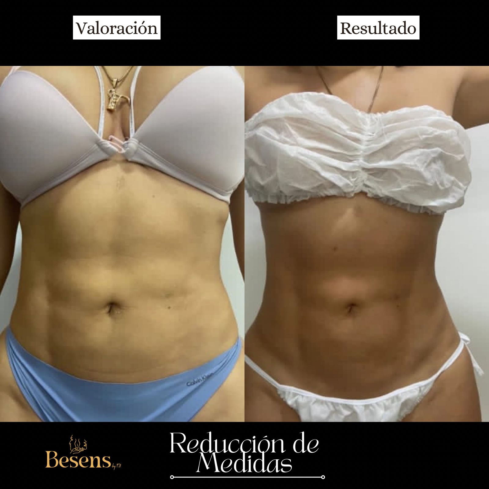 Paciente reduccion de medidas