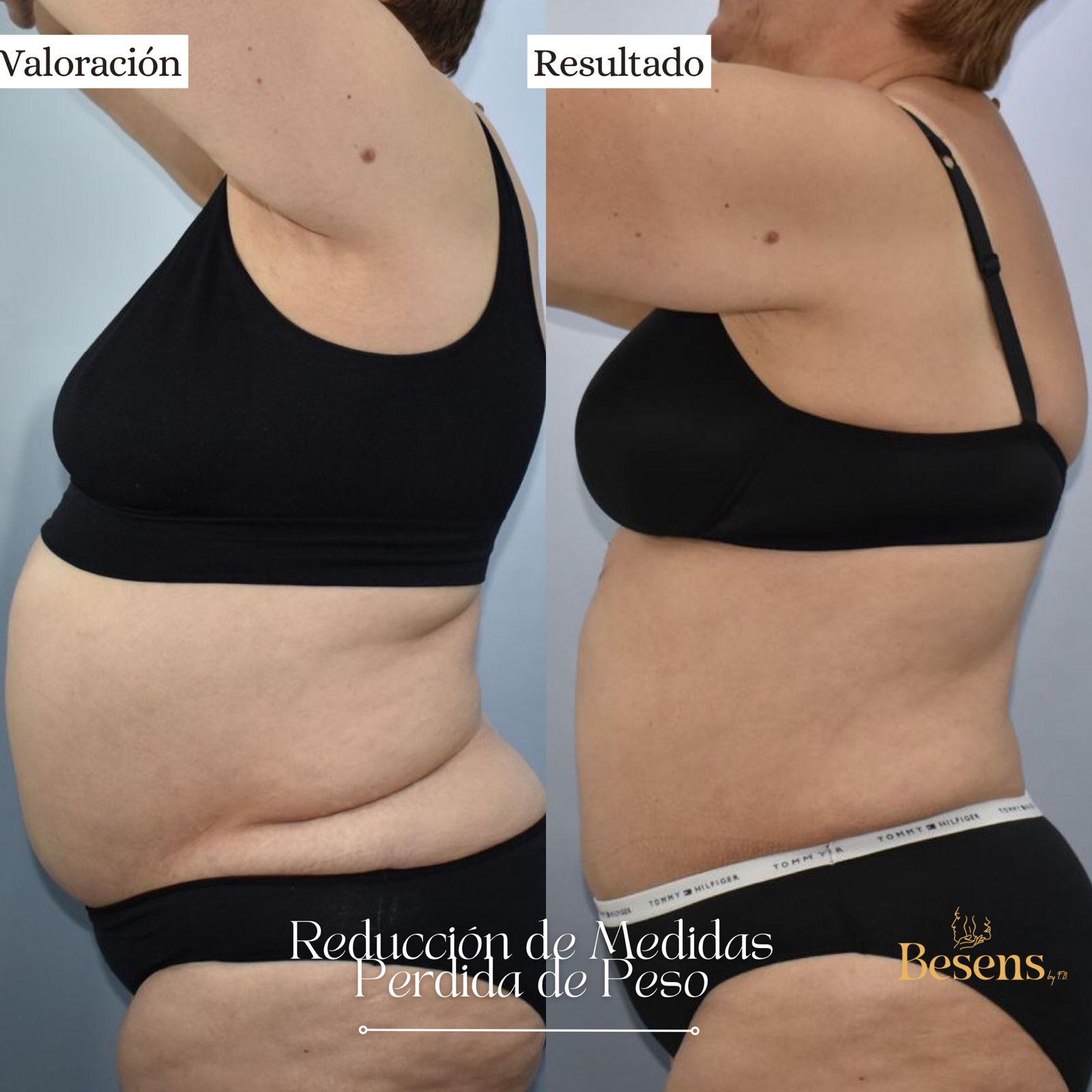 Paciente reduccion peso y medidas